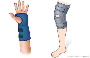 A splint on a wrist