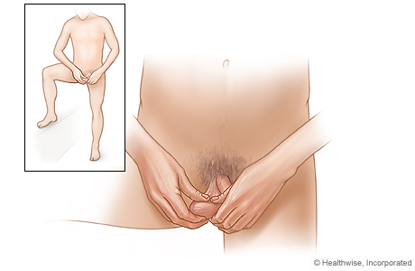 How to do a testicular self-exam