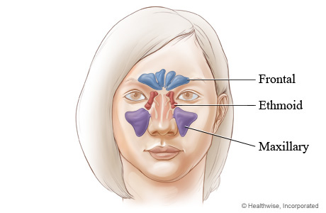 where facial sinus cavities are located (front view).