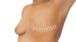 Purchase Wholesale mastectomy bras. Free Returns & Net 60 Terms on Faire
