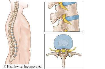 View of spine and vertebrae