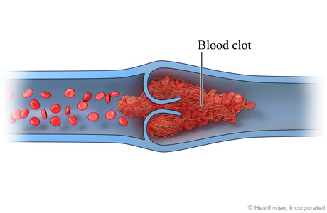 Normal venous blood flow (cross-section)