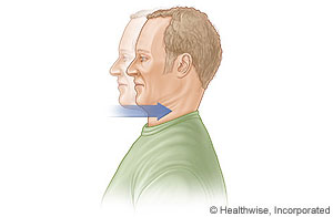 Dorsal glide neck stretch.