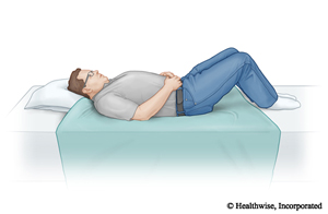 Person in bed on top of a drawsheet.