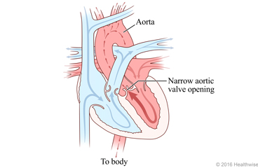 Image of fetal heart circulation