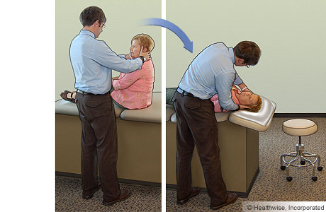 Epley manoeuvre: Step 1 Epley manoeuvre: Step 1